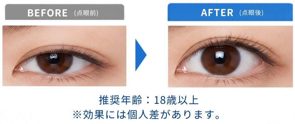 アップニークのbeforeとafter