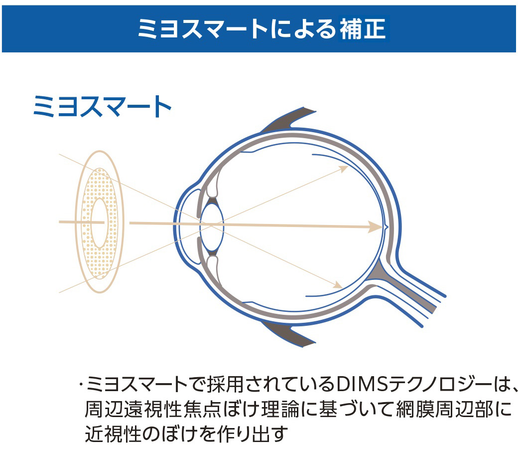 ミヨスマートによる補正